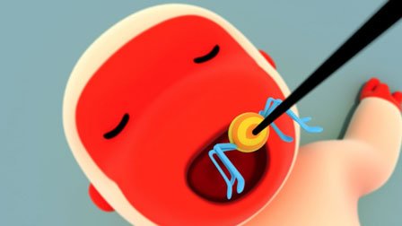 Spider Doong Doong 2 - Episode 75
