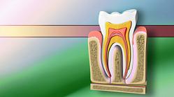 Dental Caries - Episode 110